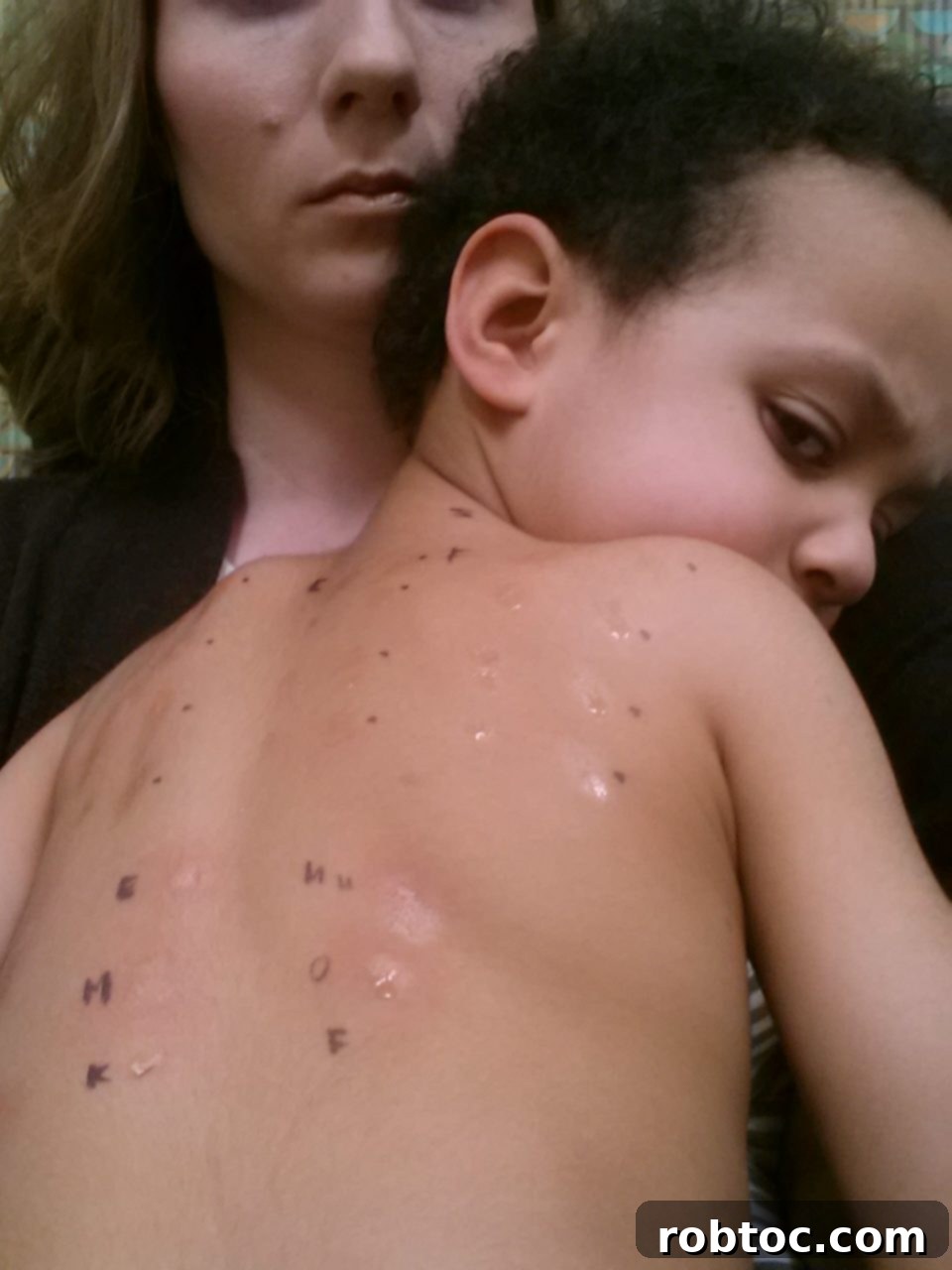 Eosinophilic Esophagitis in children, showcasing the daily challenges faced.