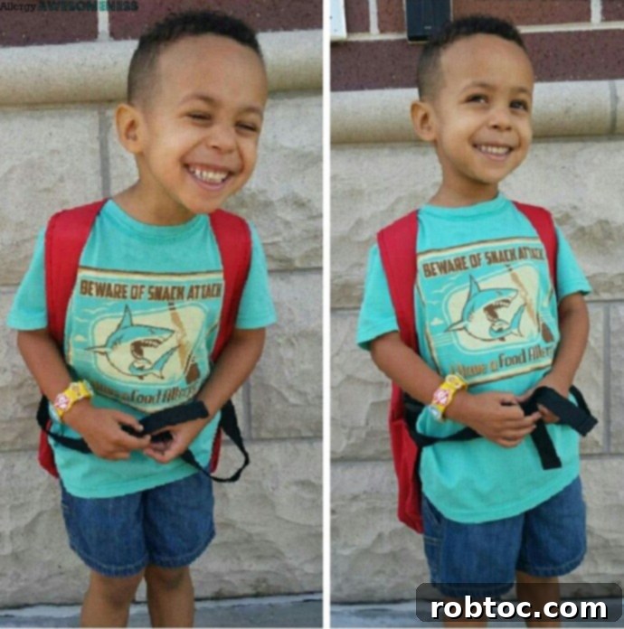 Crafting a 504 Plan for Your Child's Food Allergies 3 504-plans-for-EOE